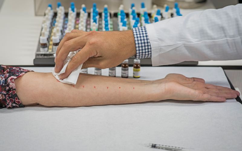 clínica de asma y alergia pruebas diagnósticas clínica ojeda clínica de asma y alergia pruebas diagnósticas clínica ojeda